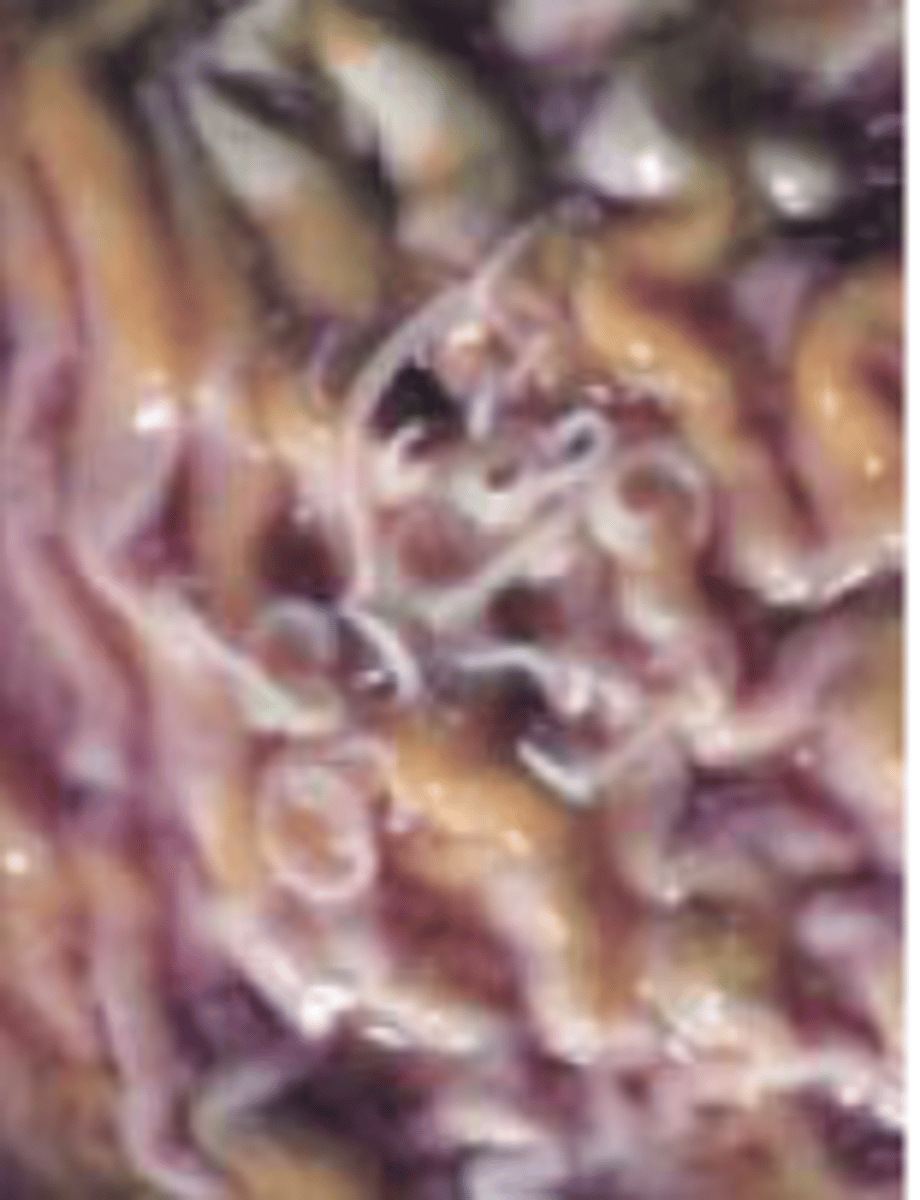 <p>Canine Stomach Worm</p><p>-stout pinkish worms, 13-48mm in length</p>
