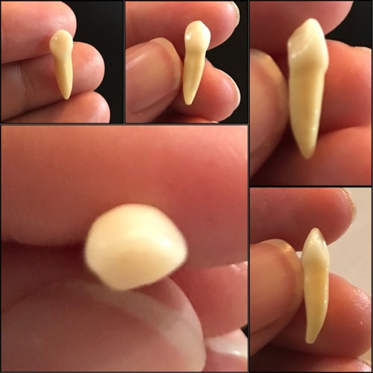 <p>What tooth is this ?</p>