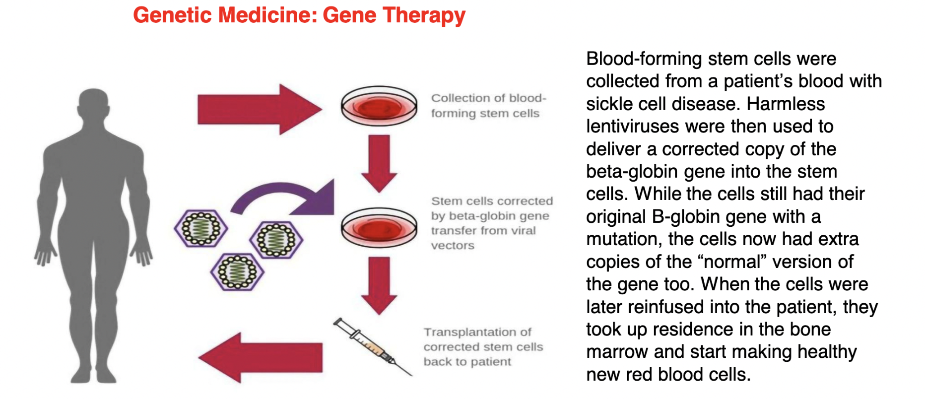 
1. blood-forming stem cells collected from a patient’s blood with sickle cell disease
2. harmless lentiviruses (type of retrovirus) used to deliver a corrected copy of β-globin gene into the stem cells 
3. ALTHOUGH the cells still have their original β-globin gene with a mutation, they now ALSO have EXTRA copies of the “normal” version of this gene too
4. when these cells are later reinfused into the patient, the cells take up residence in the bone marrow and start making healthy new red blood cells 

\
\*NOTE: still use patient’s ORIGINAL cells to prevent an immune reaction from happening (bc the body doesn’t recognize foreign cells bc they’re not the body’s own cells) 
