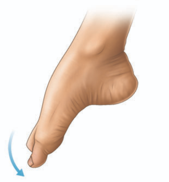 <p>extension of the foot toward the plantar surface </p>