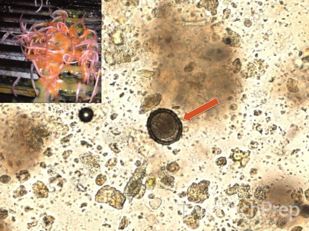 <p>what parasite is this </p><p>whats the scientific name </p>