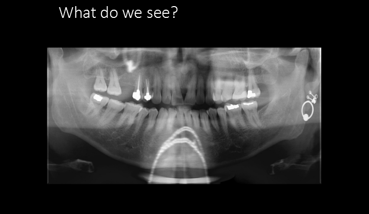 <p>What do we see?</p>