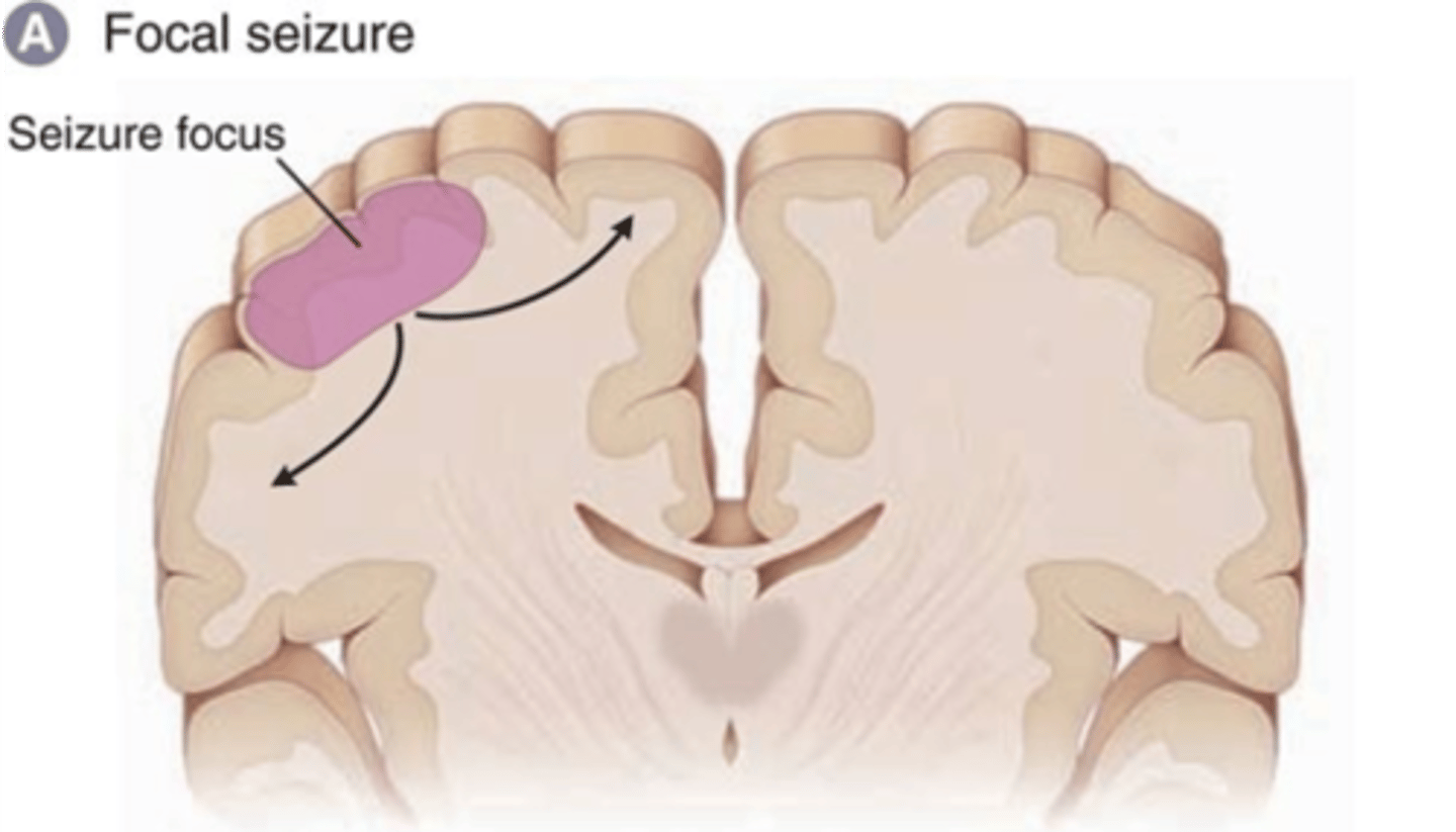 <p>Only involve 1 hemisphere</p><p>Seizure focus is only 1 area of the brain</p><p>Spread limited to the hemisphere it started in</p><p>(can progress to generalized)</p>