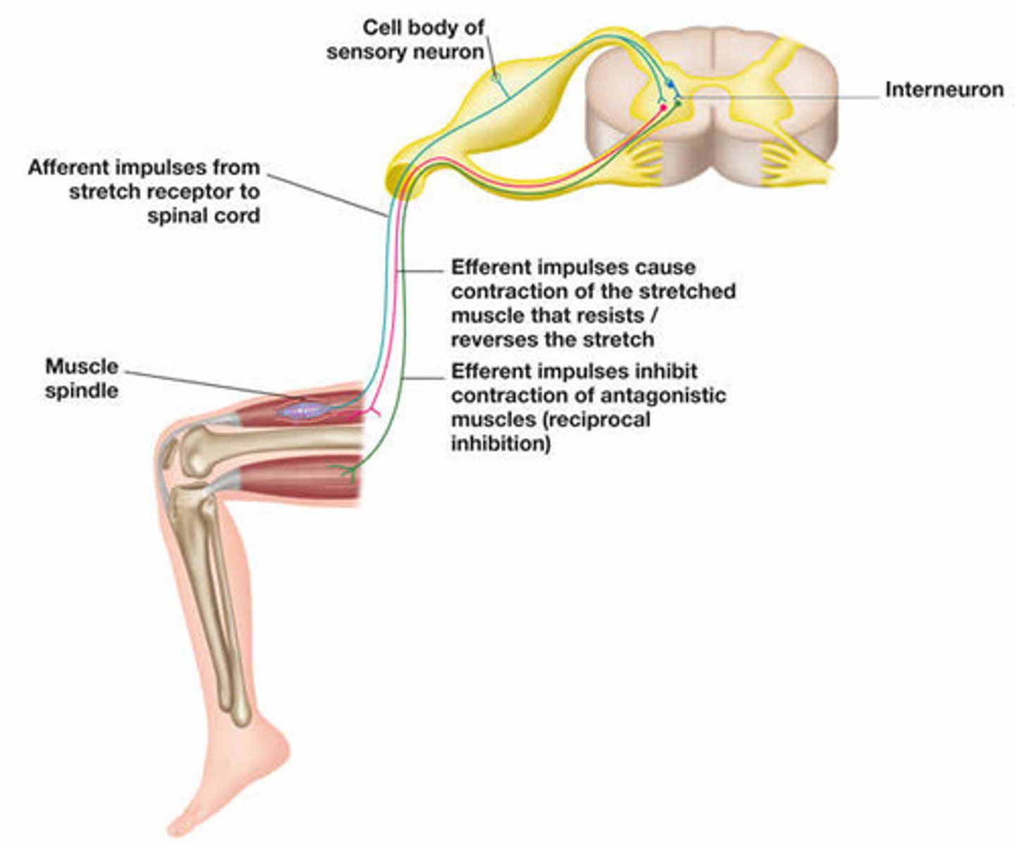 <p>True. The Combination of that excitatory Lower Motor Neuron and Inhibitory Neuron produce an effect of Reciprocal Inhibition, to ensure that the desired motion occurs.</p>
