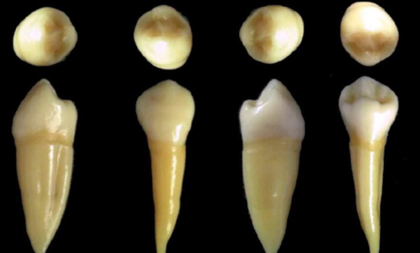 <p>what tooth is this &amp; why?</p>