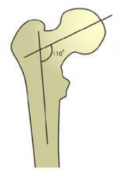 <p>Nom et caractéristiques de ce phénomène ?</p>