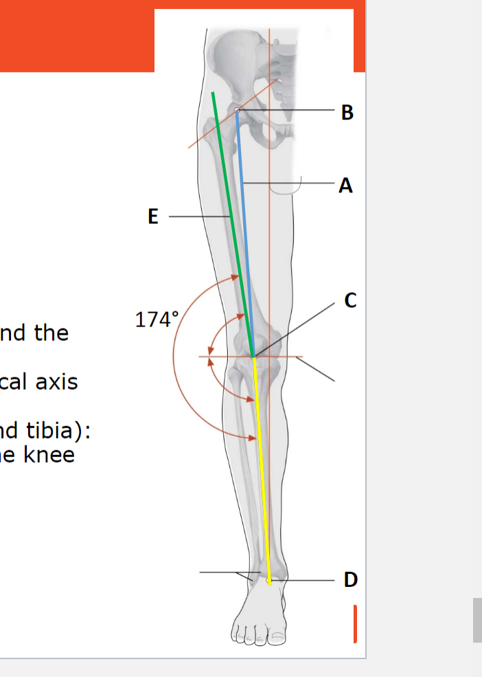 <p>Knee joint and leg axis</p>