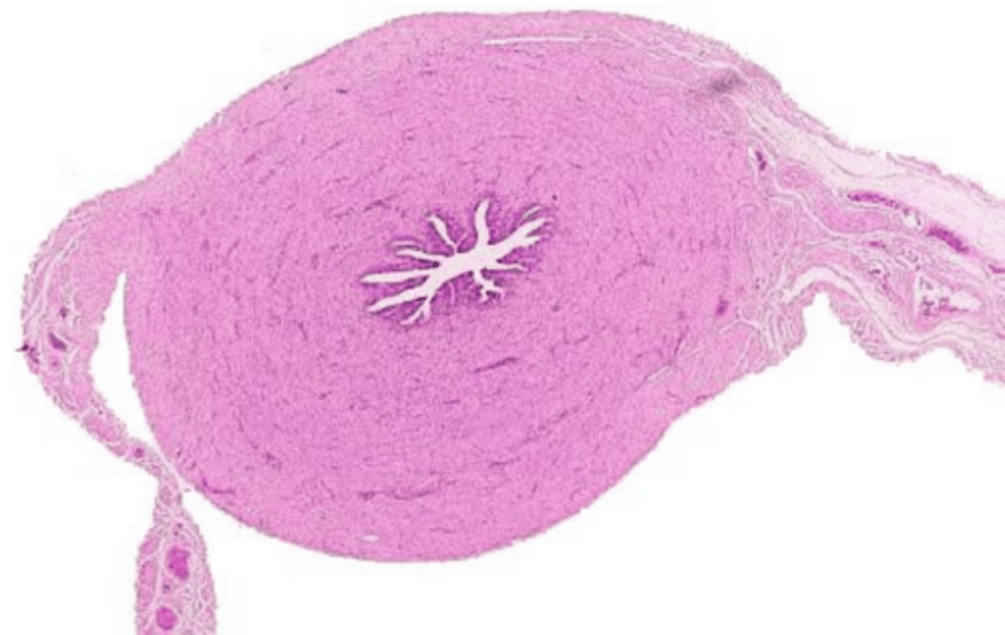 <p>why is this the isthmus of the uterine tube?</p>