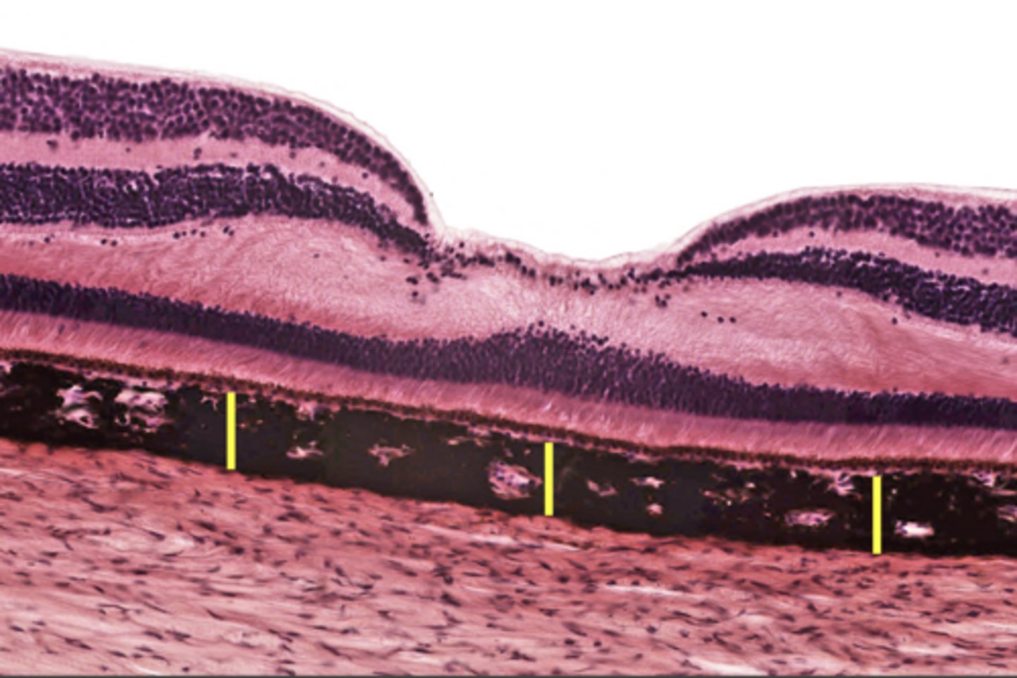 <p>dark pigmentation, blocks light from coming through</p>