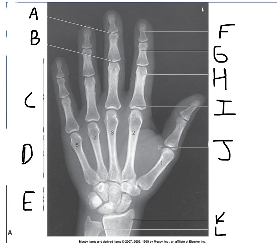 <p>What is pointed at G?</p>
