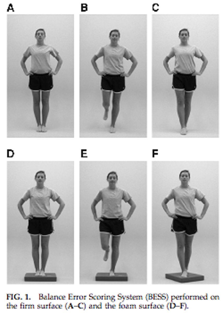 <p>is a balance assessment protocol that was developed specifically for assessing sports concussions</p>