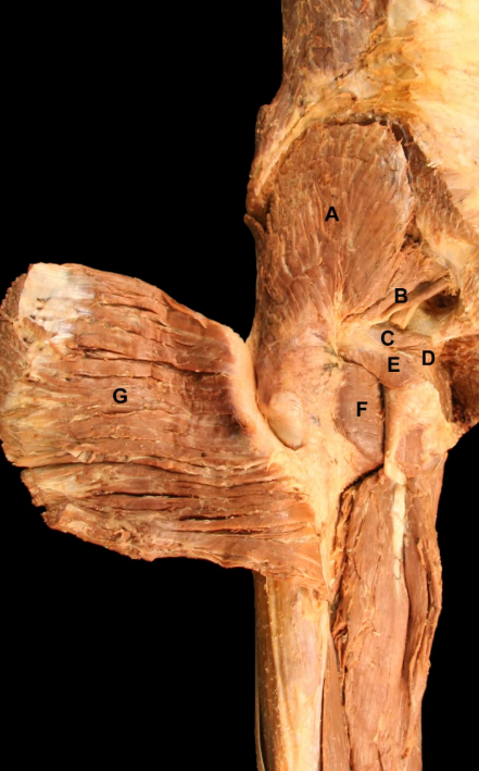 <p>E</p>