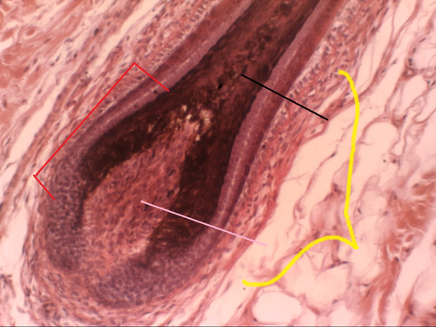 <p>expanded deep end of hair surrounded by a hair follicle receptor (root hair plexus); contains sensory nerve endings (touch receptors) and a hair matrix (actively dividing area) with stem cells and melanocytes</p>