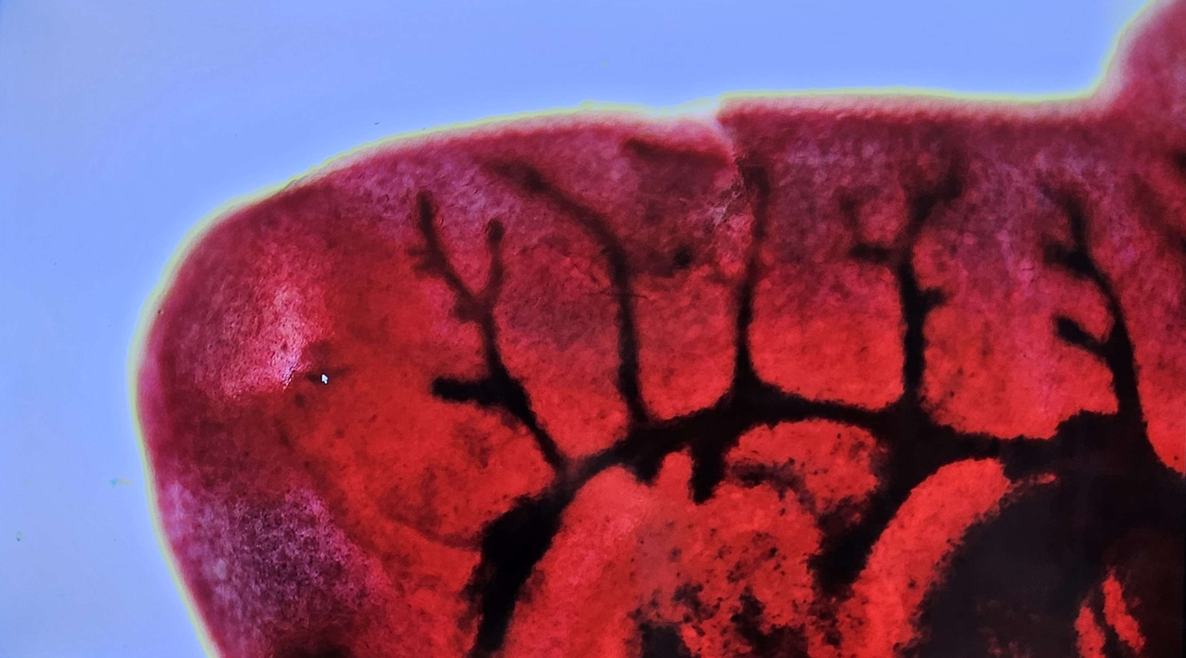 <p><span data-name="microscope" data-type="emoji">🔬</span><span data-name="petri_dish" data-type="emoji">🧫</span><strong><span> </span>Na podstawie zdjęcia preparatu:</strong></p><p></p><ul><li><p><span data-name="book" data-type="emoji">📖</span><span> </span>rozpoznaj gatunek pasożyta;</p></li></ul><p></p><ul><li><p><span data-name="recycle" data-type="emoji">♻</span><span> </span>rozpoznaj wszystkie formy rozwojowe;</p></li></ul><p></p><ul><li><p><span data-name="microbe" data-type="emoji">🦠</span><span> </span>wskaż organelle i cechy charakterystyczne dla danego gatunku;</p></li></ul><p></p><ul><li><p><span data-name="mask" data-type="emoji">😷</span><span> </span>nazwij chorobę, którą pasożyt wywołuje.</p></li></ul><p></p>