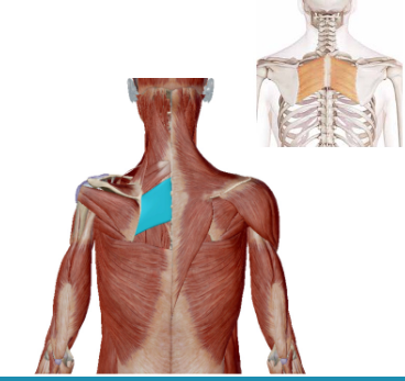 <p>Welke spier is dit</p>