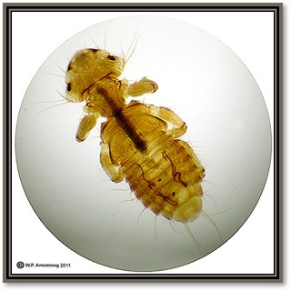 <p>Lice biting</p>