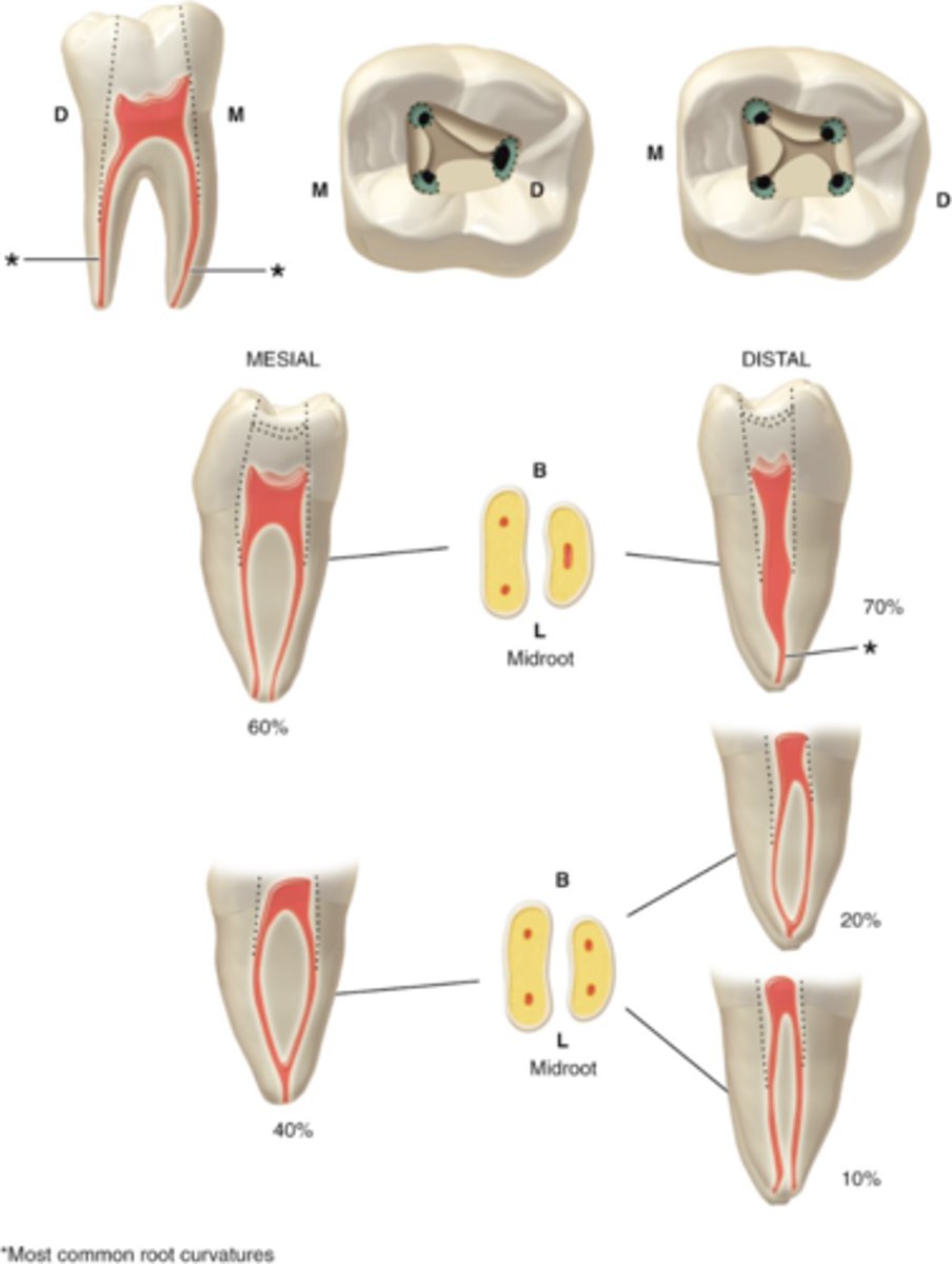 <p>mandibular first molar access shape</p>