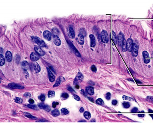 <ul><li><p>sweeps eggs -fallopian (uterine) tube</p></li></ul>