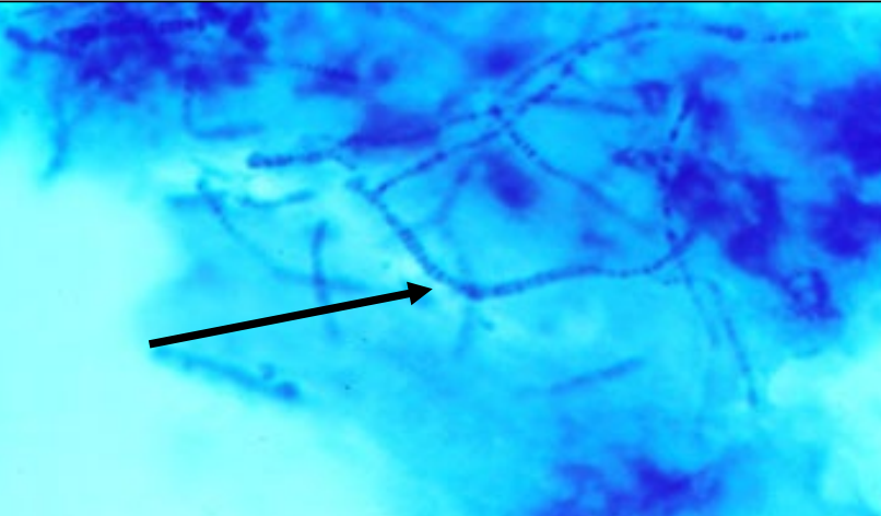 <ul><li><p>appearance of lesions</p></li><li><p>visualize organisms in scabs (Giemsa stain)</p></li></ul><p></p>