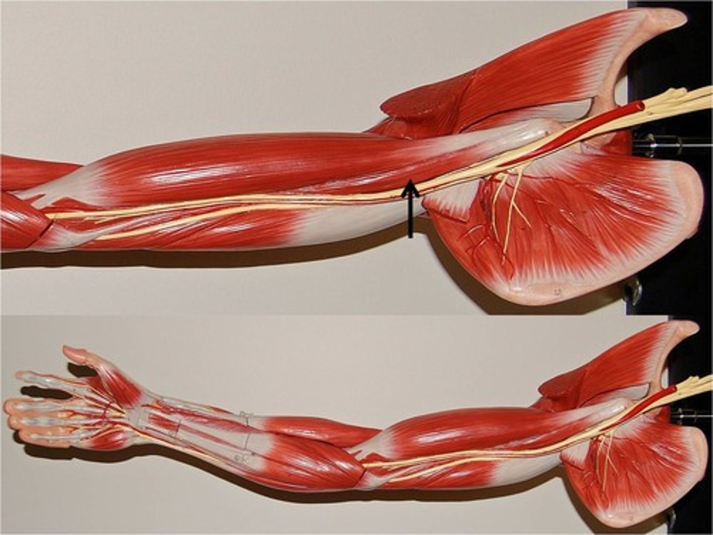<p>Flexes and adducts arm</p>