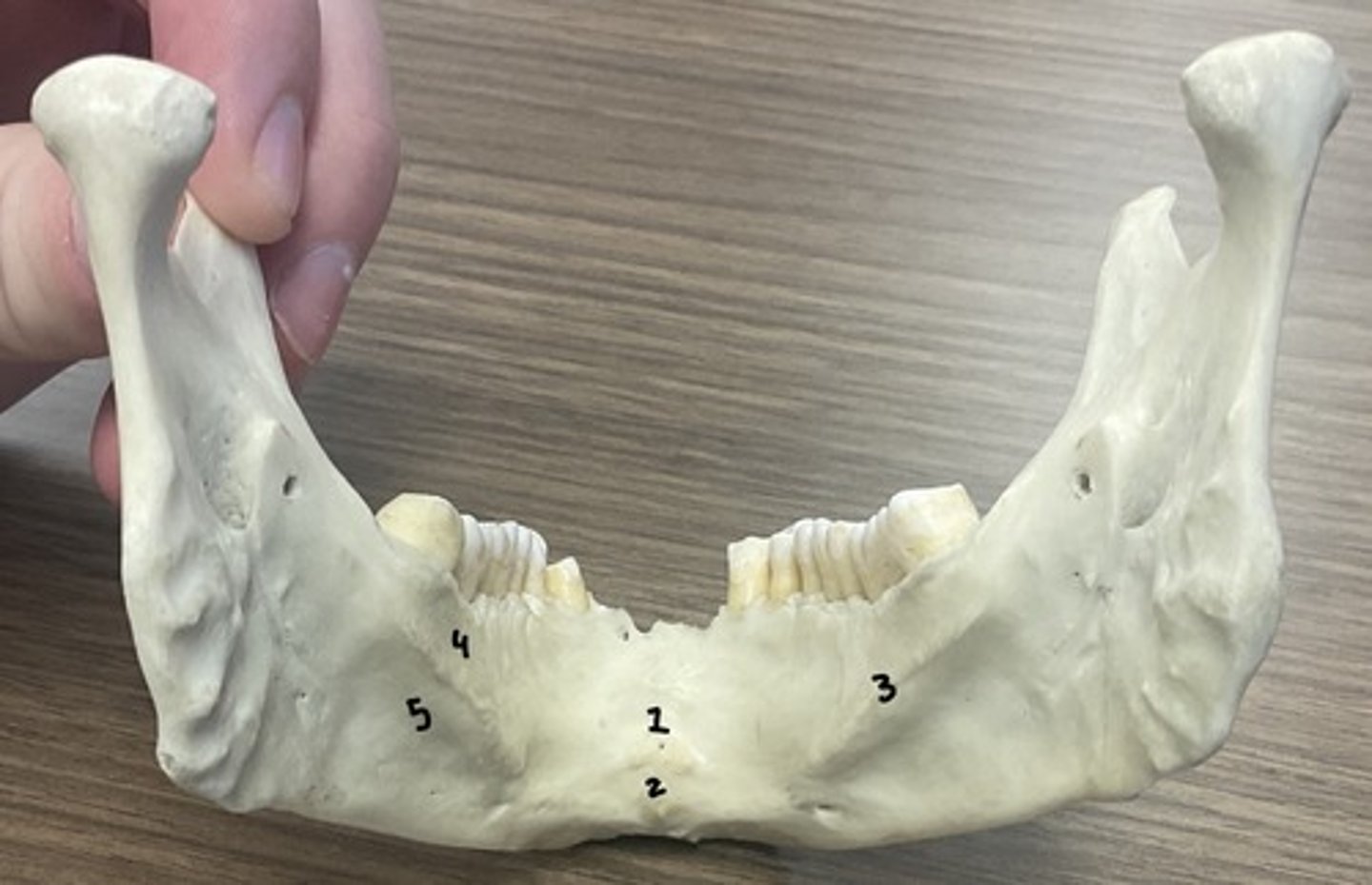 <p>What is structure 2?</p>