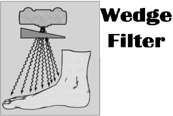 <p>Wedge filter – great for the foot</p><ul><li><p>In the foot, the thick part of the wedge should be over the <span><strong>[...]</strong></span> and the thin part of the wedge should be over the <span><strong>[...]</strong></span>&nbsp;</p></li></ul><p></p>