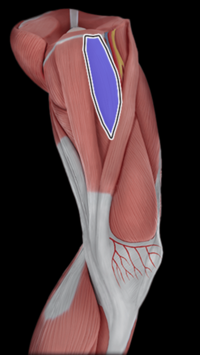<p>What Muscle Is Highlighted?</p>