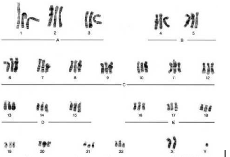 What does the picture indicate? 