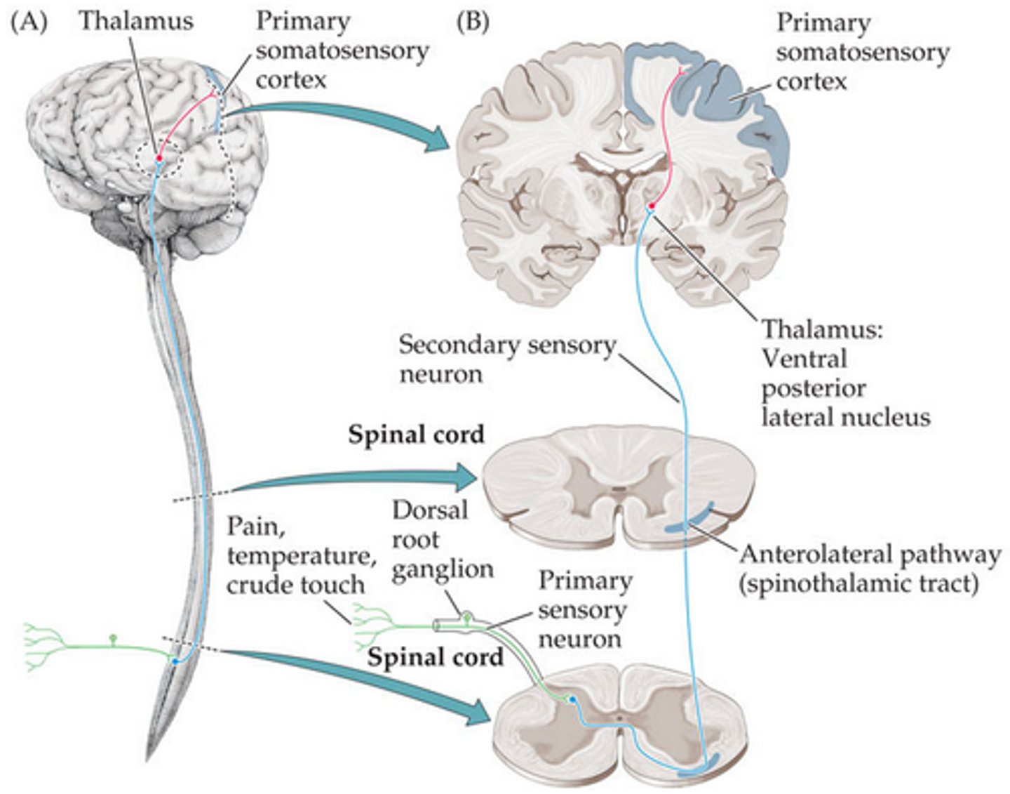 <p>The route from the spinal cord to the brain that carries most of the information about skin temperature and pain.<br><br>1. Synapses on 2nd order neurons in substantia gelatinosa<br><br>2. Decussates<br><br>3. Ascends to thalamus</p>