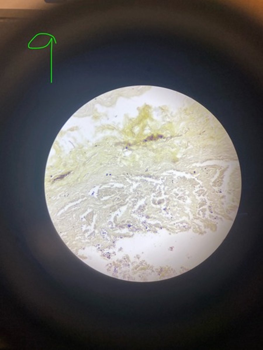 <p>What stain is this?</p>