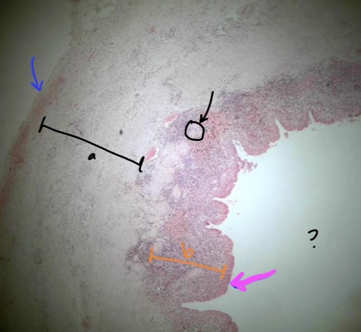 <p>specimen in the field of view</p><p>layer at tip of blue arrow</p><p>region a</p><p>structure at tip of black arrow</p><p>specific in orange bracket (b)</p><p>specific tissue at tip of magenta arrow</p><p>space where ? is at</p>