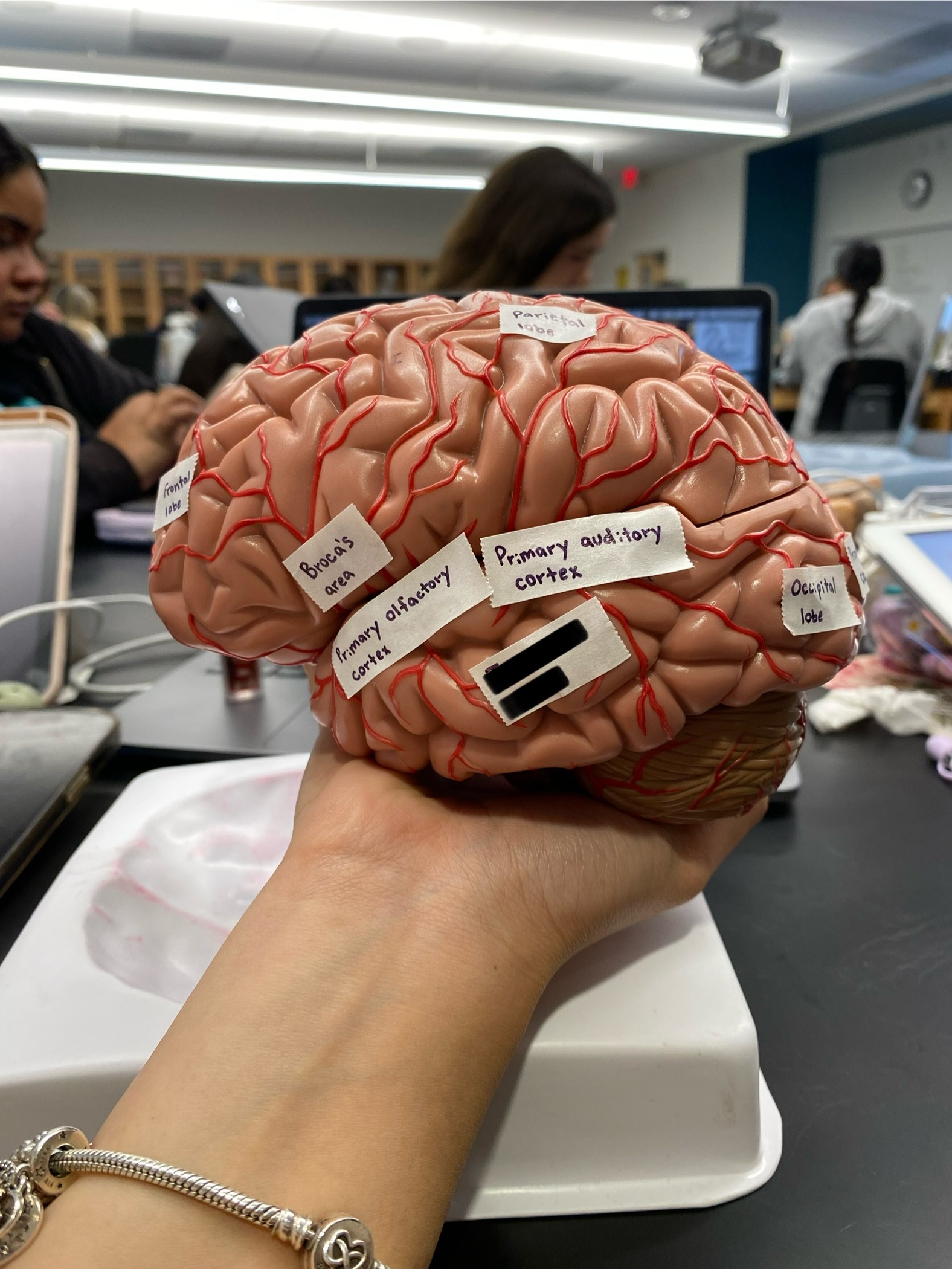 <p>ID lobe</p>