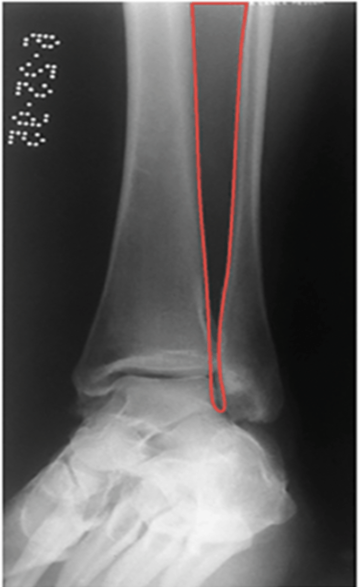 <p>What structure is highlighted?</p>