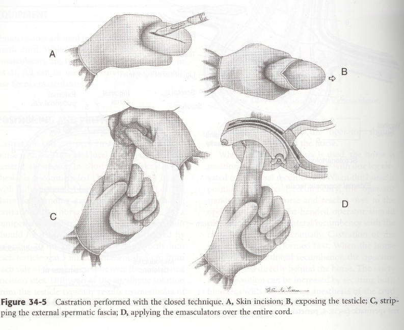 <ol><li><p>Scrotal fascia stripped away until cremaster and parietal tunic are fully exposed.</p></li><li><p>Entire spermatic cord emasculated close to superficial inguinal ring. Make sure testicular arteries are crushed!</p></li></ol><p></p>