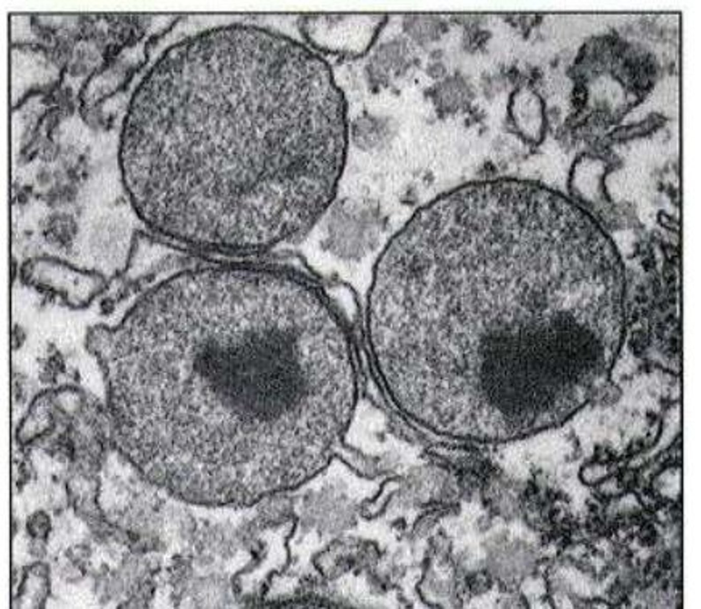 <p>• Small spherical membrane-bound organelles (d = 0.5-1 μm)</p><p>• Contain oxidase enzymes involved in oxidation of multiple substrates - detoxify harmful substances</p><p>• Important in β-oxidation of very long-chain fatty acids (C18 and above)</p>