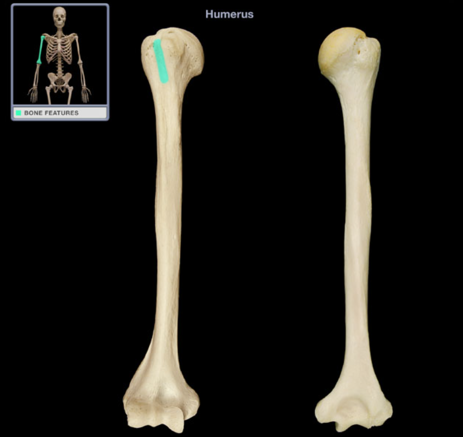 <p>Intertubercular groove (sulcus)</p>