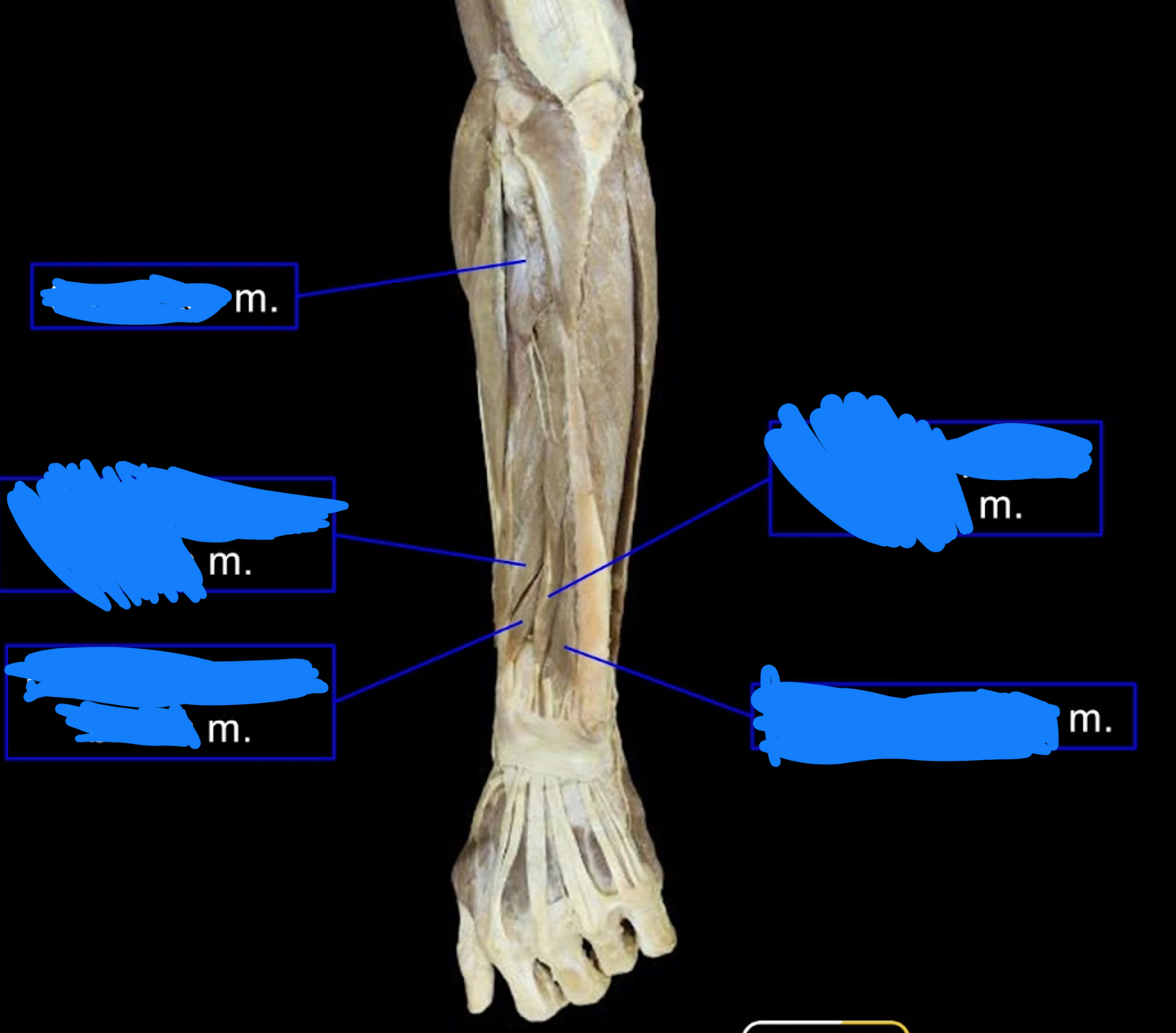<p>middle left muscle</p>