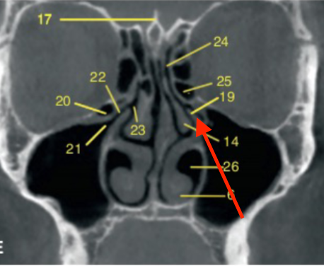 <p>identify structure </p>