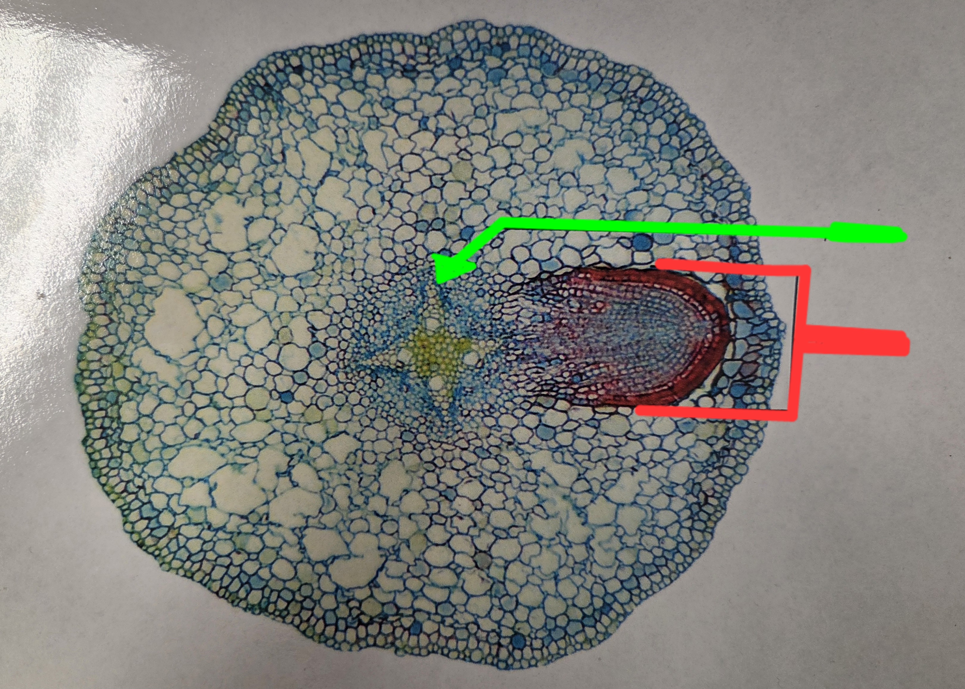 <p>What is being labeled by a green arrow?</p>