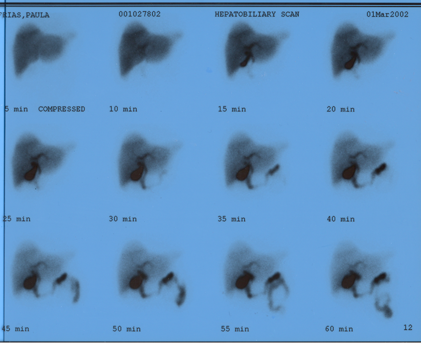 <p>what is this pictuer showing?</p>