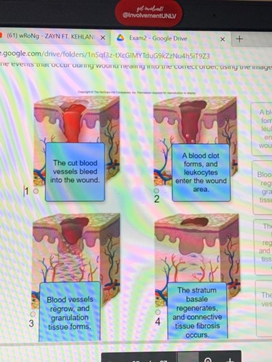 <p>Wound healing</p>