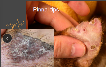 <p><span>Vasculitis</span></p>