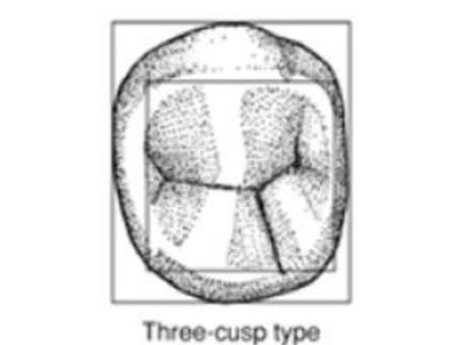 <p>The exception to coronal tooth dimension (wider faciolingual than mesiodistal) is the ___ w/ 3 cusp version</p>