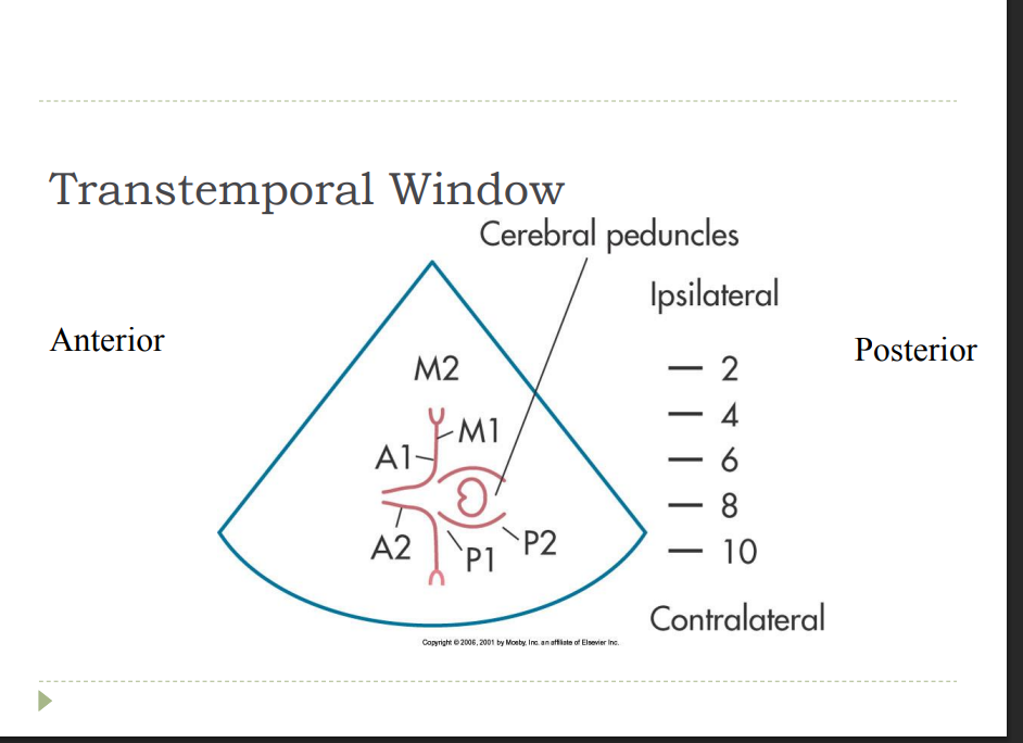 <p>Transtemporal Window  Image orientation  Ipsilateral hemisphere is at the “top” of monitor-Contralateral hemisphere is at the bottom</p><p></p><p>Anterior to the left and posterior to the right</p>