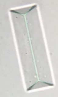 <ol start="64">
<li>What are Struvites?</li>
</ol>