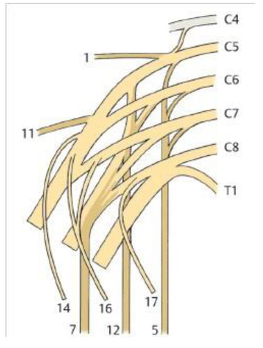 <p>Identify 17</p>