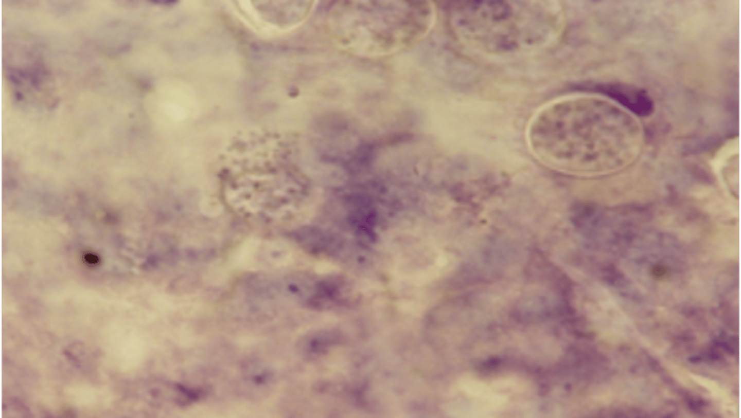 <p>Slide from a dead chicken - What parasite and life stage is this?</p>