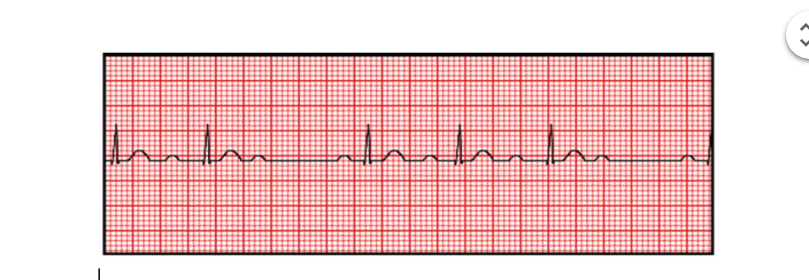 <p>How do you treat this</p>
