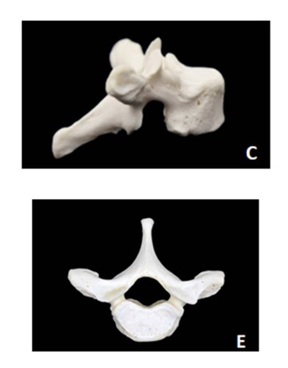 <p>ID the vertebra and view</p>