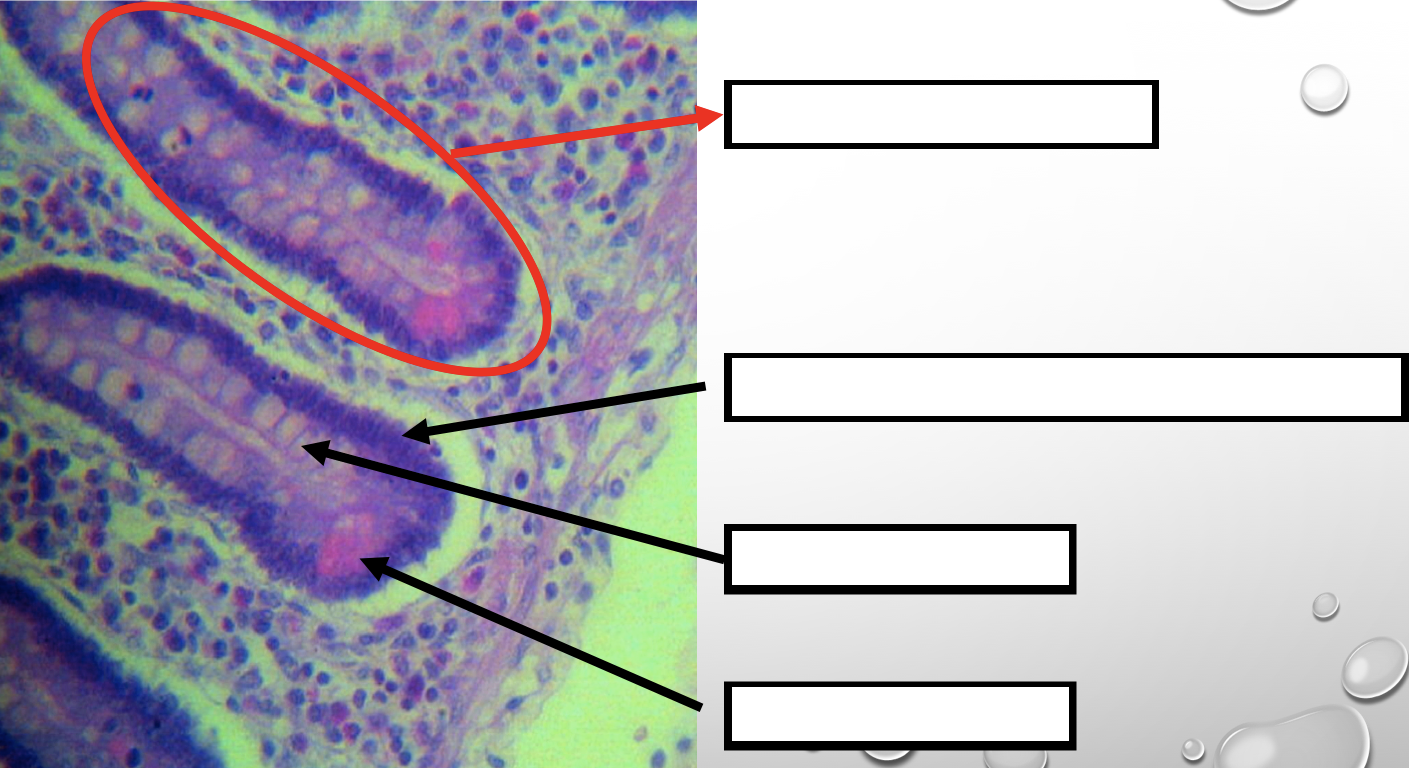 <p>Mucin producing epithelial cells</p>